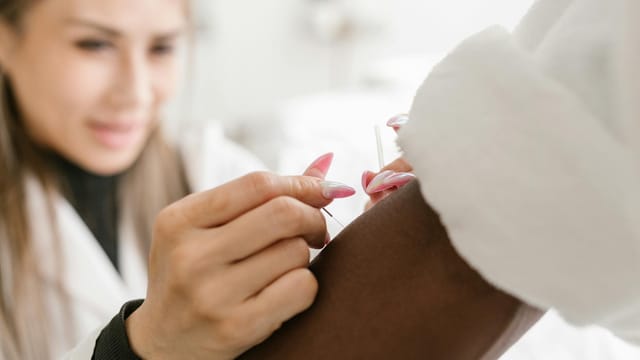 Close-up of a therapist performing acupuncture on a client's arm, promoting holistic health and wellness.