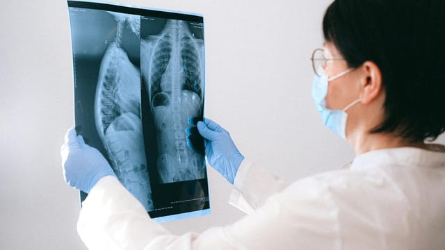 Medical professional in mask and gloves examining a chest X-ray indoors.