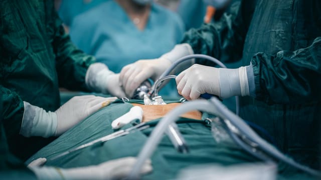 A detailed view of surgeons in action during an operation, highlighting surgical precision.