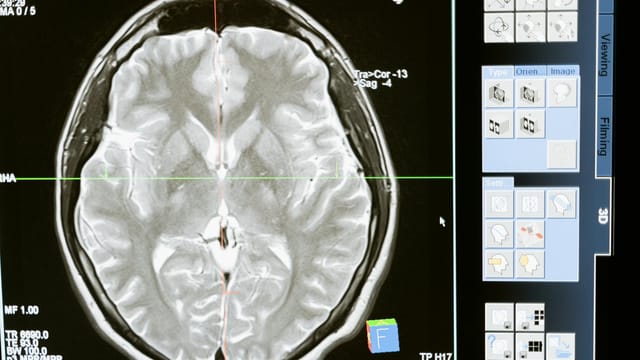 Intricate MRI brain scan displayed on a computer screen for medical analysis and diagnosis.