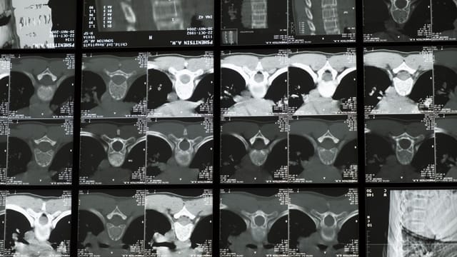 High-resolution radiological images showcasing the complex structure of the human spine for medical examination.