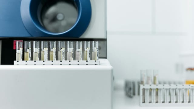 Detailed image of laboratory equipment with rows of test tubes ready for analysis.