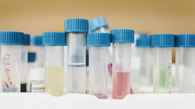 Close-up of colorful test tubes with blue caps in a laboratory setting.