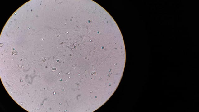 Close-up view of bacteria under a microscope, showing cellular structures.