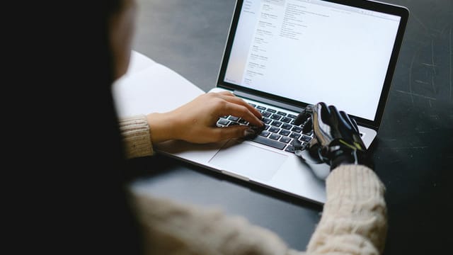 A person with a prosthetic hand using a laptop, showcasing technology and inclusivity.