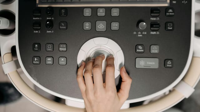 Close-up of hand operating ultrasound machine, illustrating medical technology usage.