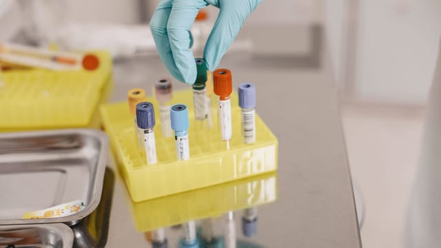 A gloved hand handling vials in a laboratory setting, emphasizing safety and precision.